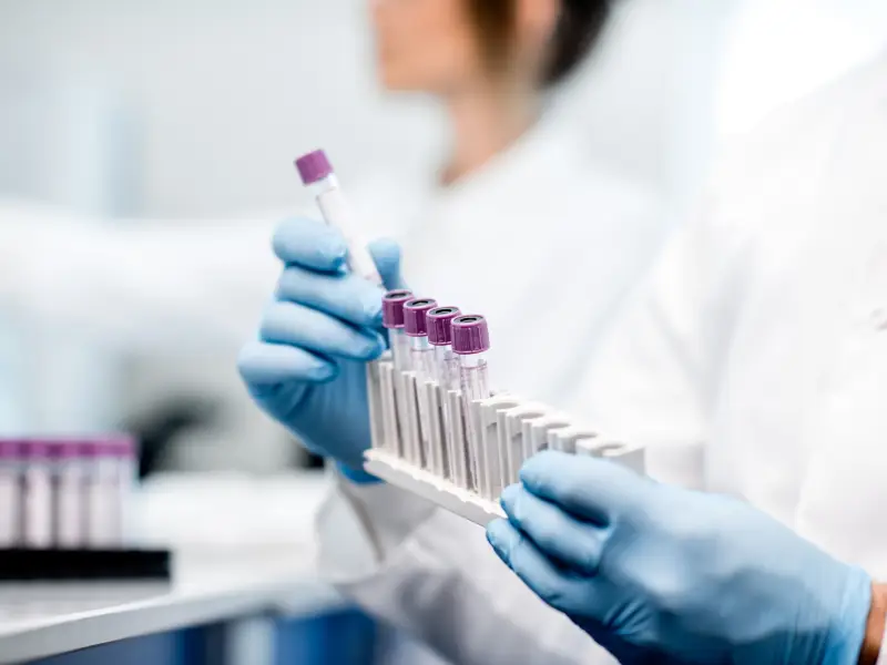 Exames laboratoriais